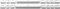 SteelSeries PrismCaps Universal Keycaps, Kunststoff (PBT) Double-Shot, weiß, 105 Tasten, ISO-DE Vorschaubild