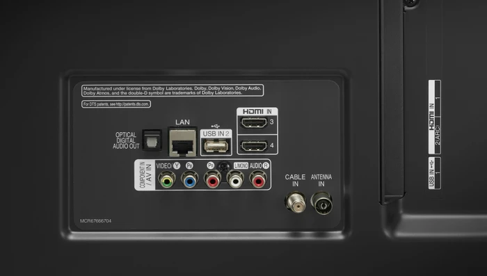 LG 75UN81006LB