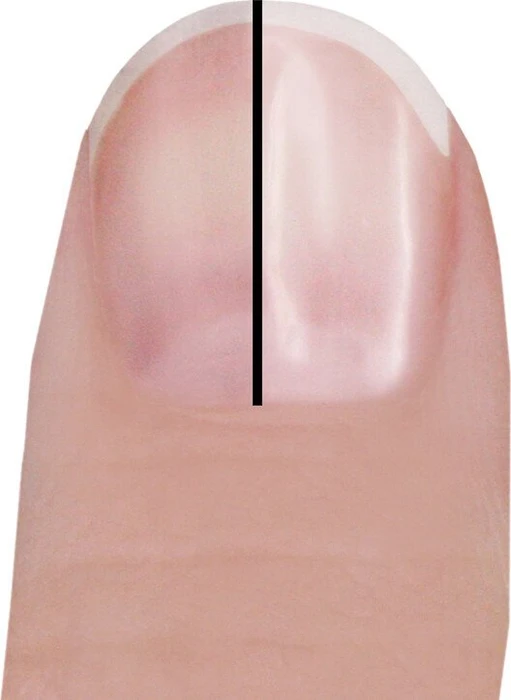 Trisa Perfect Nails Elektrischer Nagelpolierer rosa