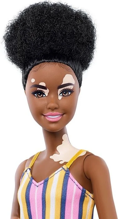 Mattel Barbie - Fashionistas mit Vitiligo und Afro in gestreiftem Kleid