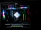 Cooler Master MasterLiquid ML240 Illusion Vorschaubild