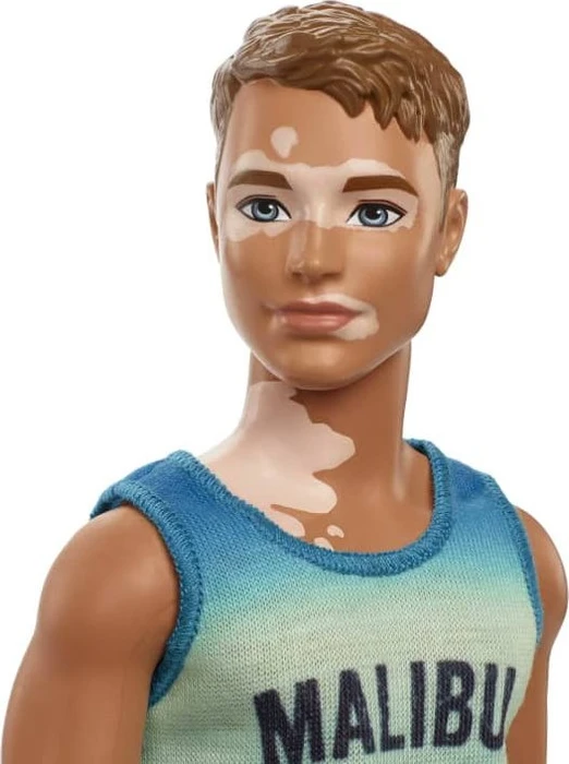Mattel Barbie - Fashionistas Ken im Malibu-Tanktop Vitiligo