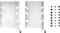 Fractal Design HDD Tray Kit - Type B, weiß Vorschaubild
