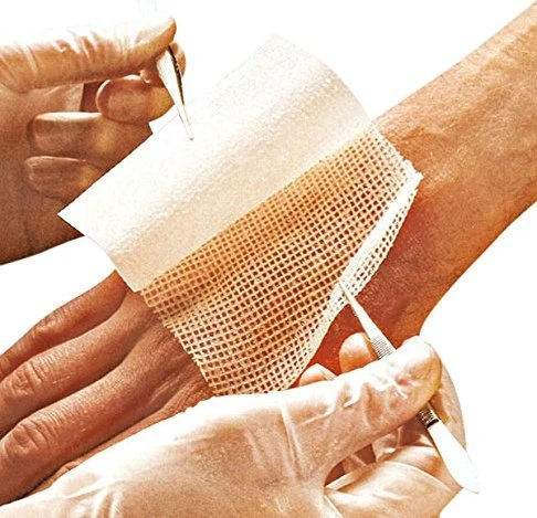 Smith & Nephew Jelonet Paraffingaze steril, 10 x 40cm, 10 Stück
